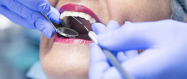 Best Dentist for Tooth Abscess  in Gates Mills, OH